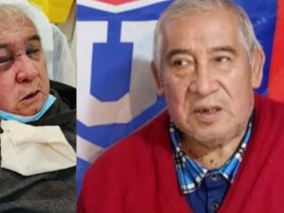 Conserje pierde visión de su ojo tras brutal agresión en Vitacura