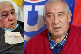 Conserje pierde visión de su ojo tras brutal agresión en Vitacura