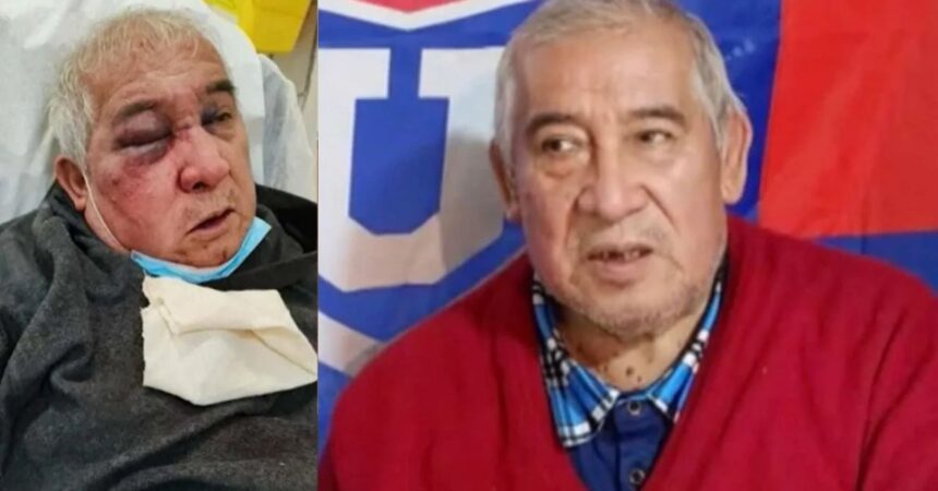 Conserje pierde visión de su ojo tras brutal agresión en Vitacura