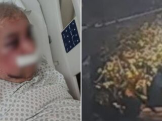 Víctima podría perder un ojo: agresor quedó con firma mensual y arraigo nacional por 100 días