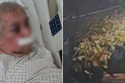 Víctima podría perder un ojo: agresor quedó con firma mensual y arraigo nacional por 100 días