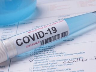Origen del Covid-19 sigue sin esclarecerse: OMS mantiene abierta la hipótesis de fuga de laboratorio