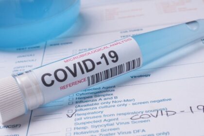 Origen del Covid-19 sigue sin esclarecerse: OMS mantiene abierta la hipótesis de fuga de laboratorio